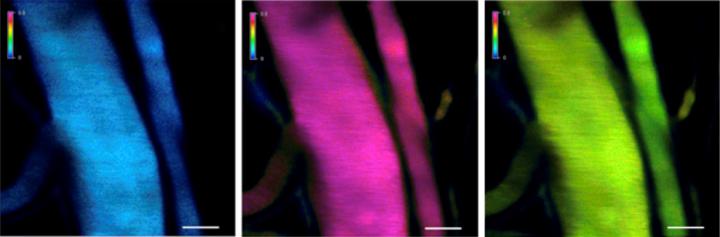 Laser Scanning Microscope Images of Blood Vessels in a Mouse Following Treatment