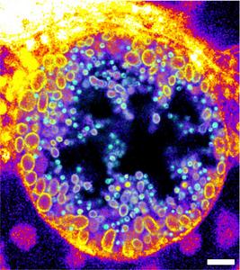 Trifunctional sphingomyelins for Visualisation of Infectious Processes