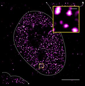 Super-resolution imaging of the androgen receptor in human prostate adenocarcinoma cell