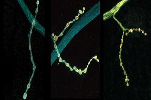 RNA editing of Complexin