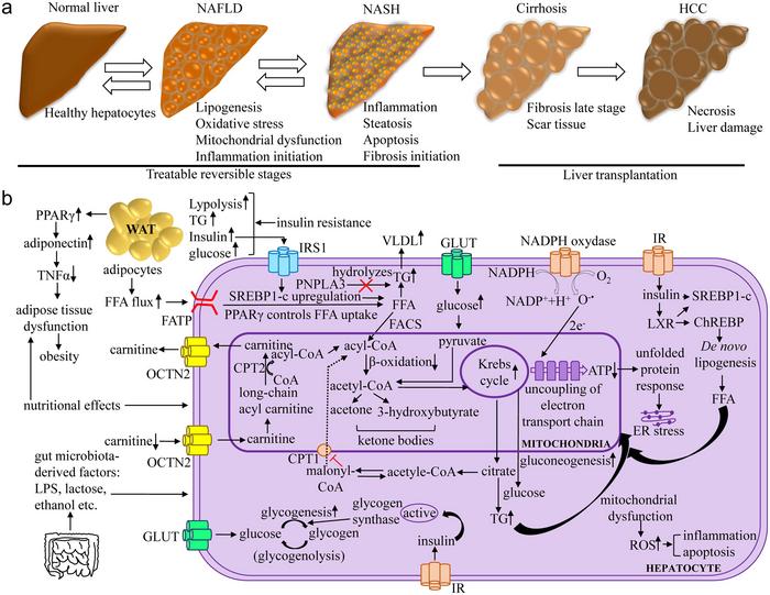 Different stages of pathophysiological conditions, starting from NAFLD to HCC, can be characterized based on the biological and molecular aspect (Panel A). The molecular understanding of multifactorial NAFLD pathogenesis (panel B)