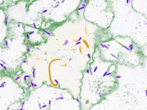 Burkholderia bacteria with cells