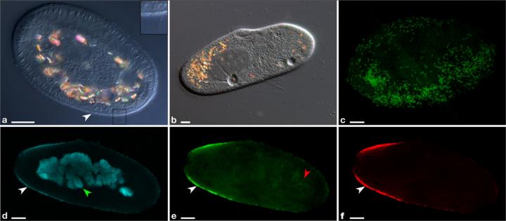 Invasion of a Paramecium Cell by Deaniraea Bacteria