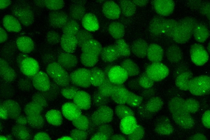 Fluorescent proteins