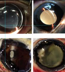 New Hydrogel (left) and Conventional Gel (right) Administered to Rabbits' Eyes