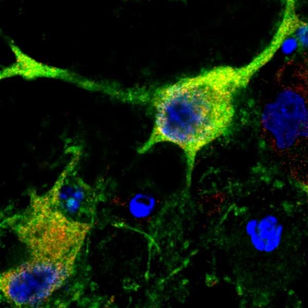 Mouse Neuron Partially Damaged by Hypoxia