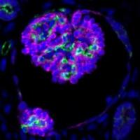 Stem Cell-Derived Kidneys Connect to Blood Vessels When Transplanted Into Mice