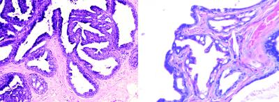 Images of a Mammary Lesion