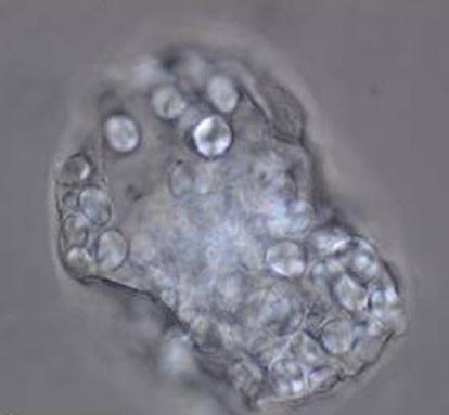 Dental Hygiene, Caveman Style