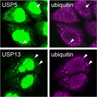 Delayed Disassembly of Stress Granules in Cells without USP5 and USP13
