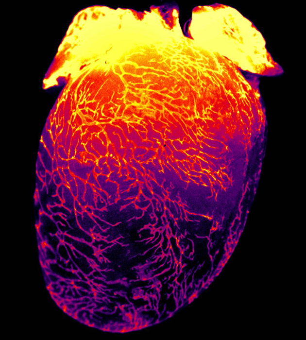 Heart Lymphatics