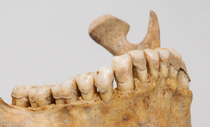 Ancient dental calculus