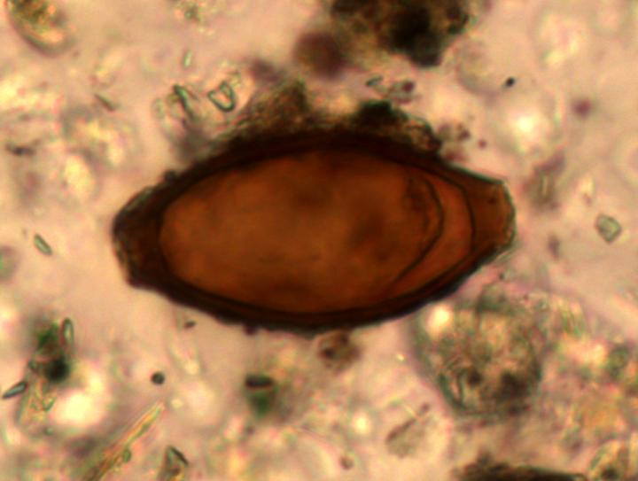 Roman Whipworm Egg from Turkey