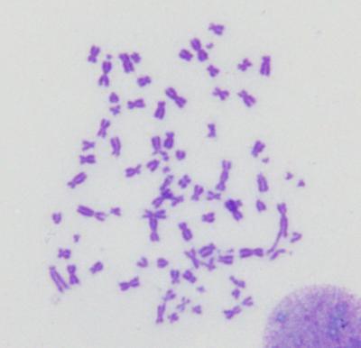 BRCA1-deficient Cell