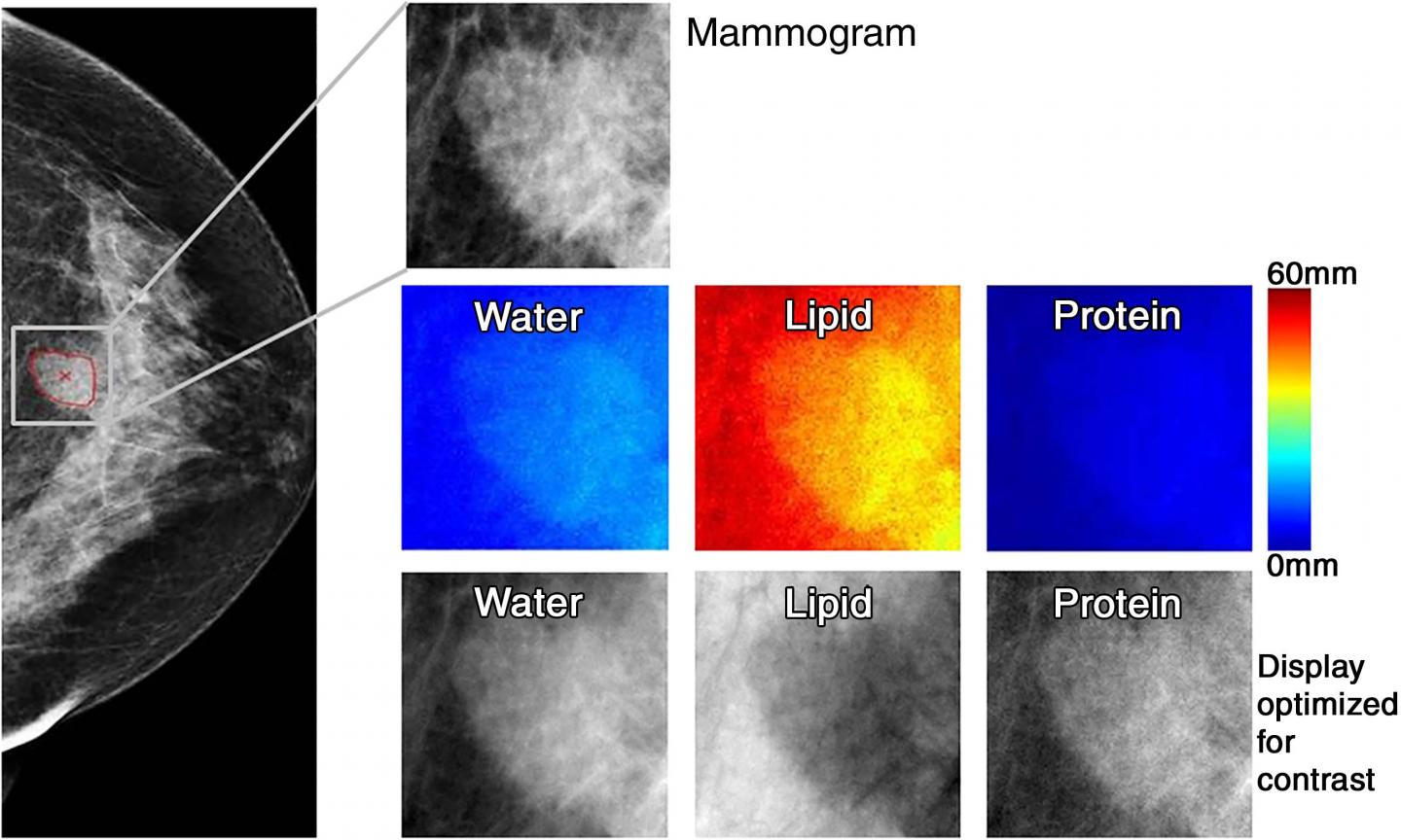 Novel Technique May Significantly Reduce Breast Biopsies