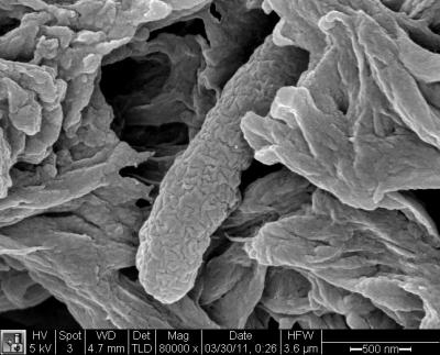 Dead <i>E. coli</i> after Treatment with New Nanoscavenger