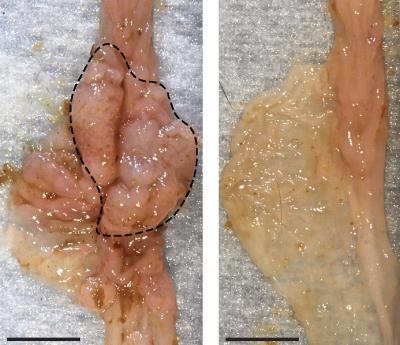 Intestinal Tumors in Mice