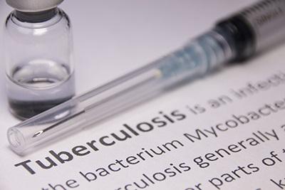 Blood Test to Predict TB