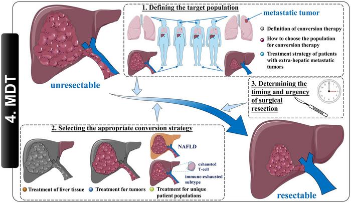 Improving the Conversion Success Rate of Hepatocellular Carcinoma