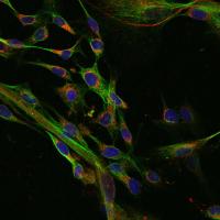 Human Fibroblasts Derived From SCNT-ESCs