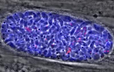 <em>Toxoplasma</em> Cyst Showing Dormant Parasite