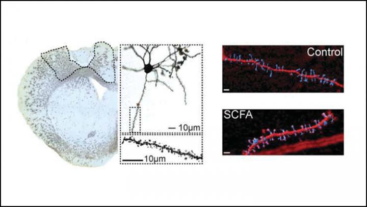 Harnessing the Microbiome to Improve Stroke Recovery