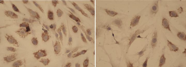Comparison of Myelofibrosis Models by Collagen Staining