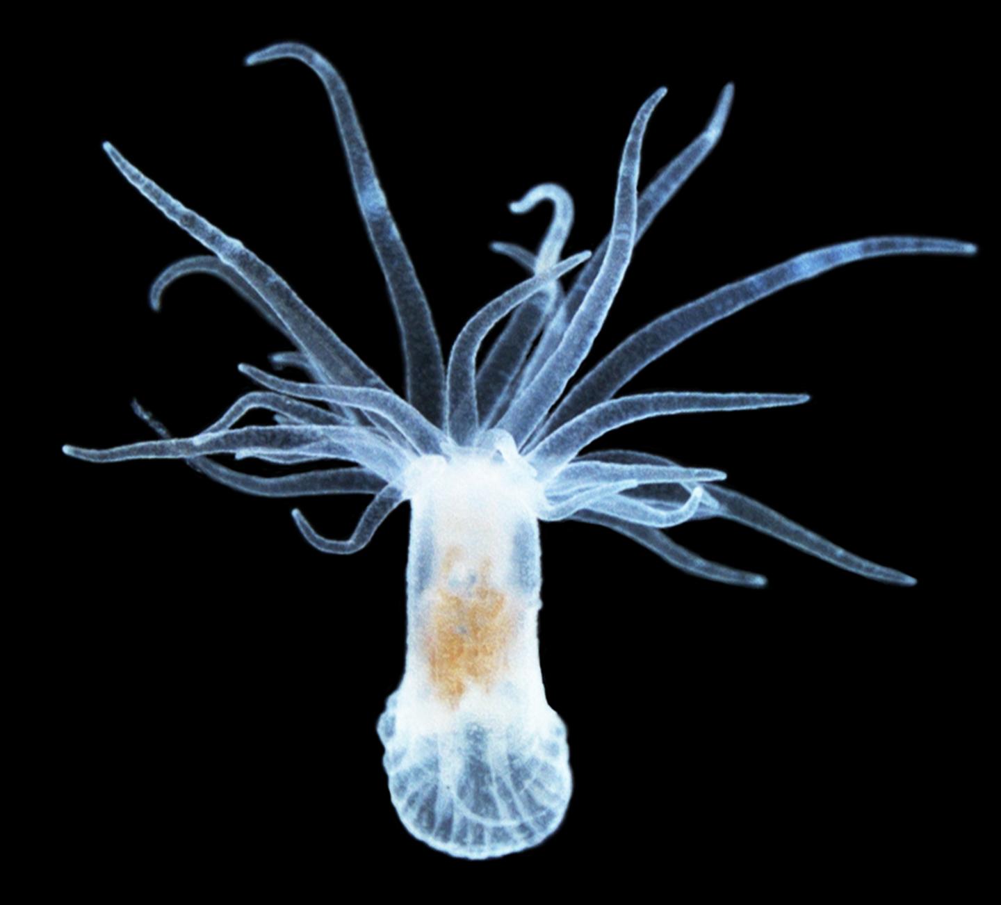 Aposymbiotic <em>Aiptasia</em> (2 of 3)