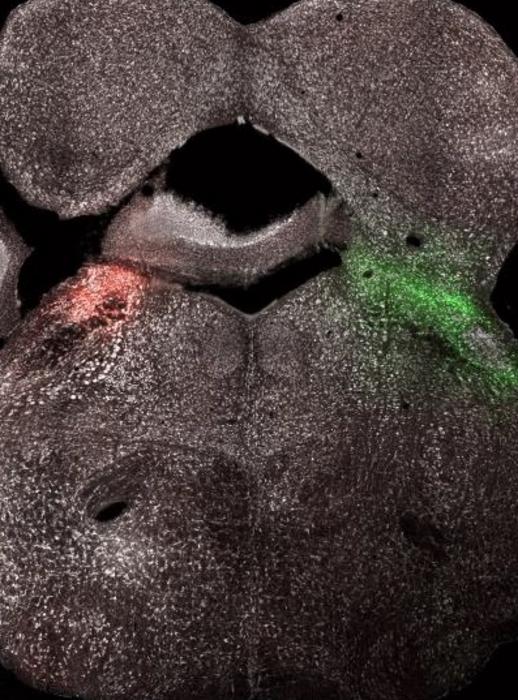 LPBN neurons labelled with fluorescence protein