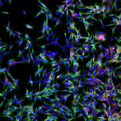 New Drug Target in Neurons