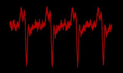 NIST/JILA 'Dark Pulse Laser' Produces Bursts of ... Almost Nothing