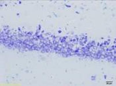Pretreatment with l-3-n-butylphthalide