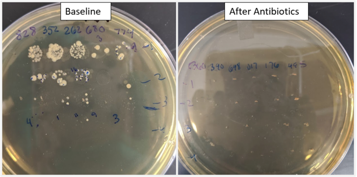 microbiota after antibiotics
