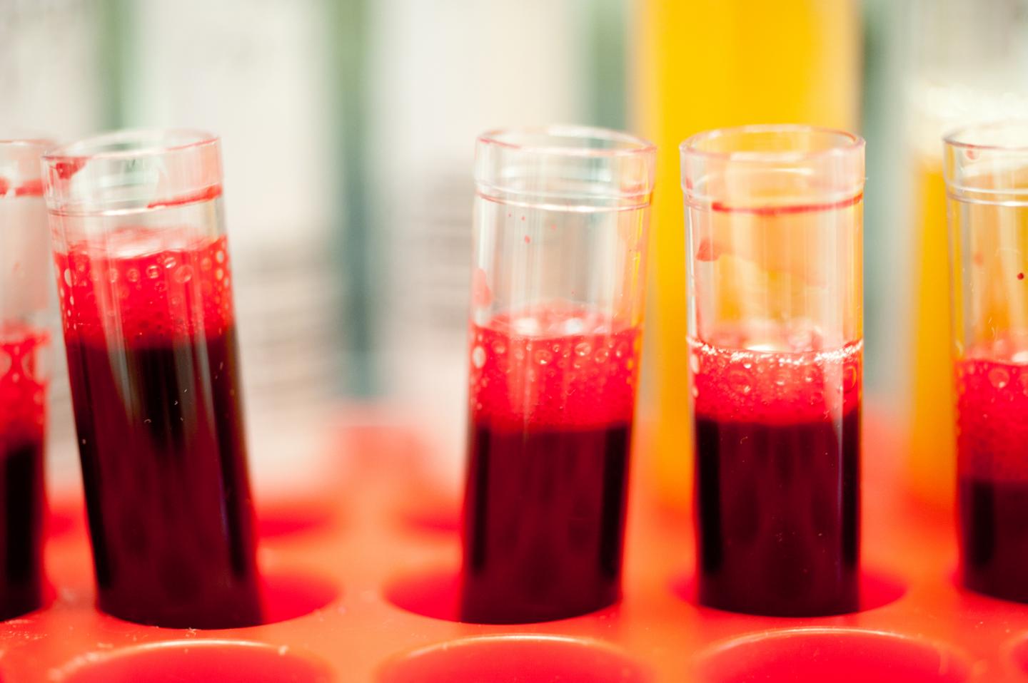 Blood Sample Test Tubes