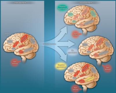 When in Pain, Gloomy Outlook Proves True (1 of 3)