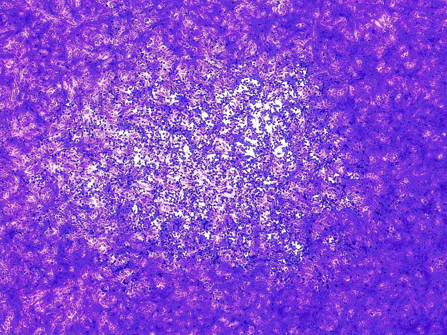 Prior Asymptomatic Zika Infection Protects Against Reinfection in Pregnant Mice