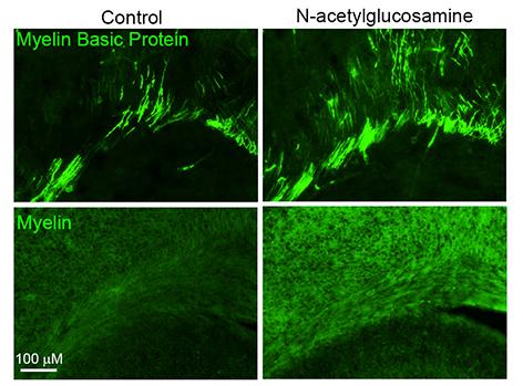 N-acetylglucosamine promotes primary myelination.