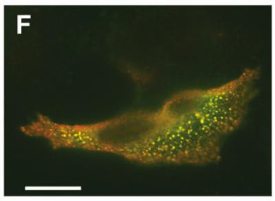 Enzyme Complex Could be Key to New Cancer Treatments (2 of 2)