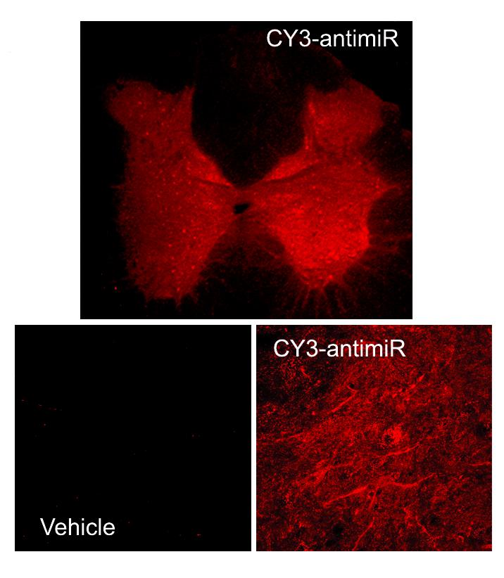 An RNA Gives Researchers a Leg Up on Chronic Pain (1 of 1)