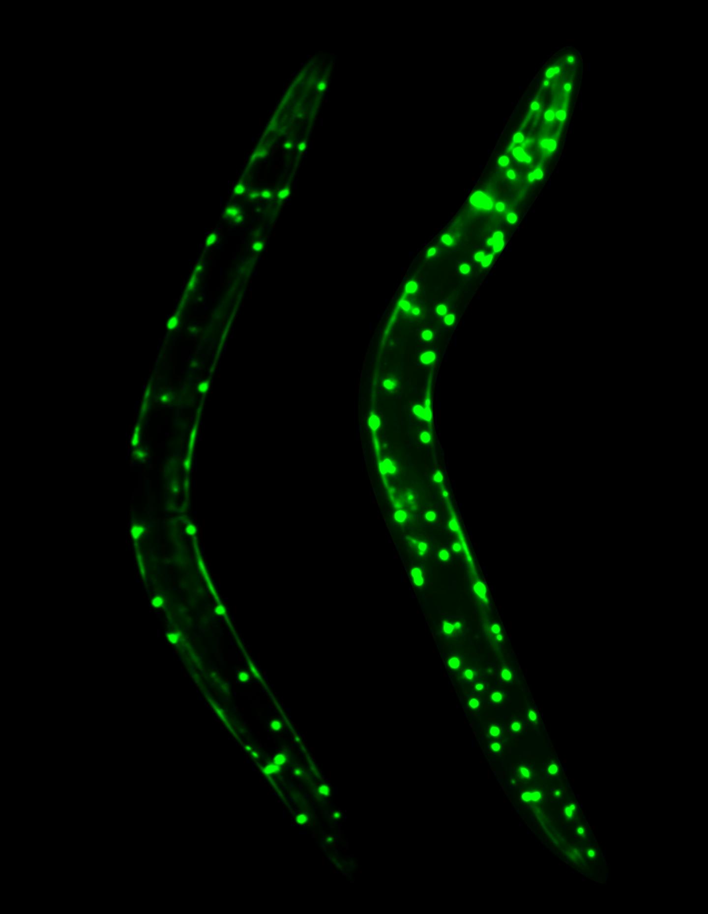 It's Not Just What You're Eating, It's What's Eating You