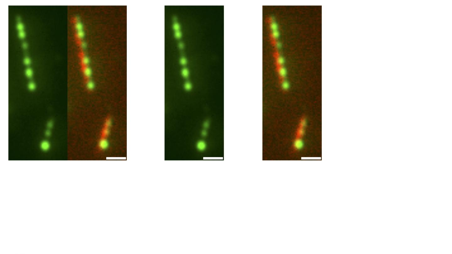 Micrograph: TPX2 beading on microtubules