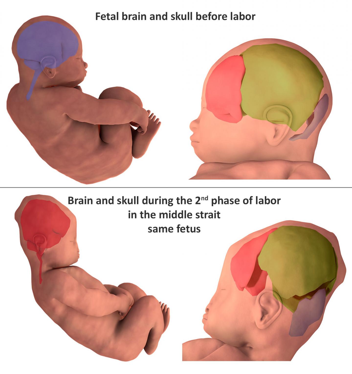 3D Images Reveal How Infants' Heads Change Shape During Birth