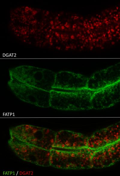 FATP1-DGAT2 Complex