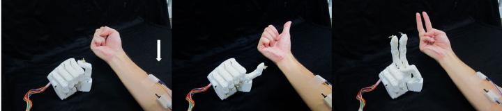 Different Hand Positions of the Prosthetic Hand