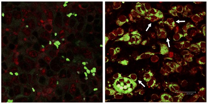 Resolvins Stimulate Uptake of Tumor Cell Debris