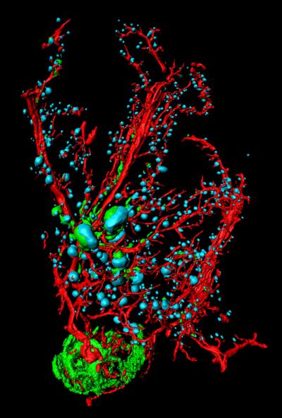 Image of a Pancreas from a Mouse with Type-1 Diabetes