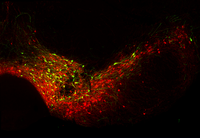Dopaminergic neurons in the midbrain of a mouse (red):