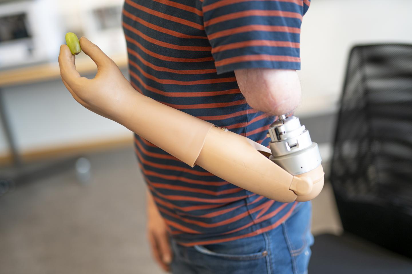 RIC prosthetic arm compared with the 25 th percentile female arm.