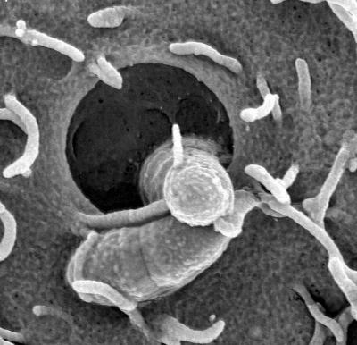 <i>Streptococcus pyogenes</i>