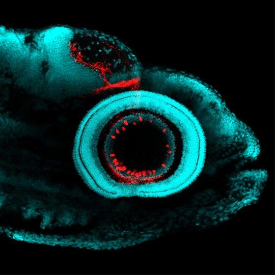 Zebrafish Retina